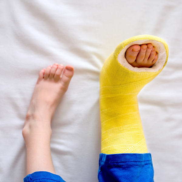 Broken Foot
